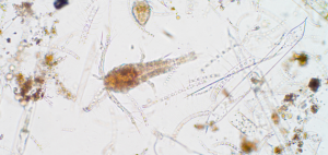 Microscopic phytoplankton.